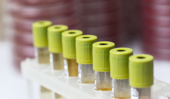 ��è����